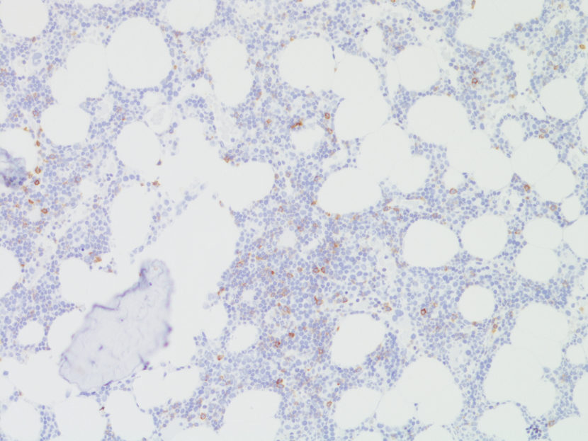 Artefacts and pitfalls under staining and interpretation – Antibody Lexicon