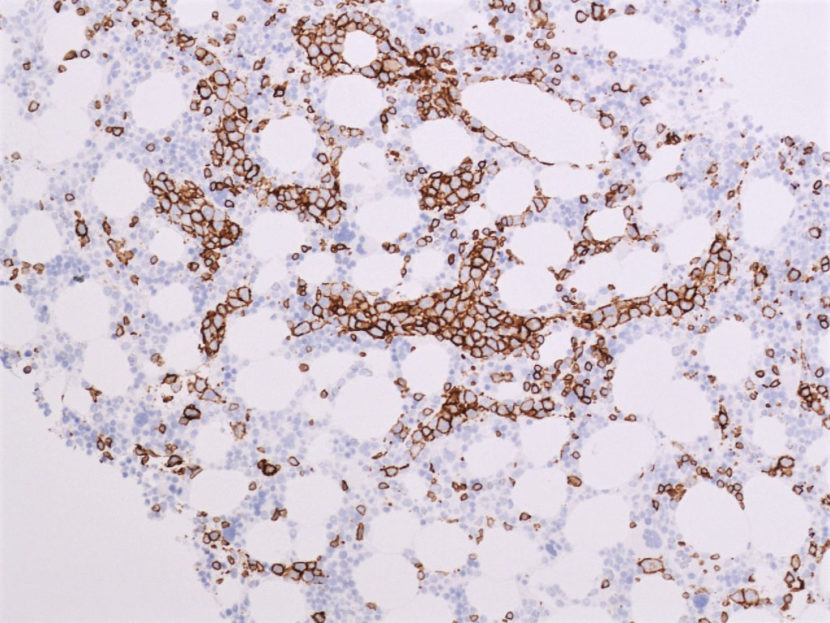 CD5 – Antibody Lexicon