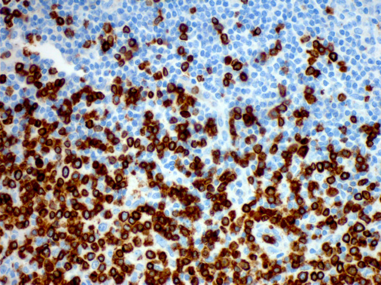 CD3 – Antibody Lexicon