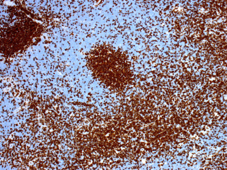 CD3 – Antibody Lexicon