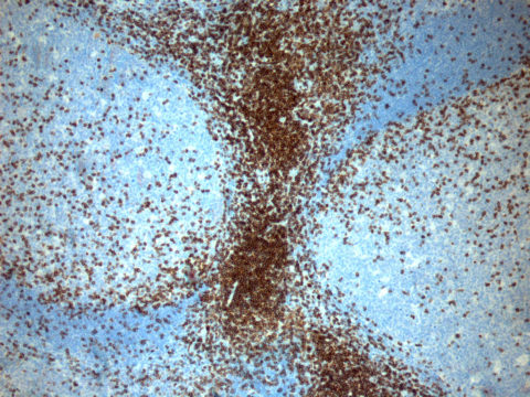 CD3 – Antibody Lexicon