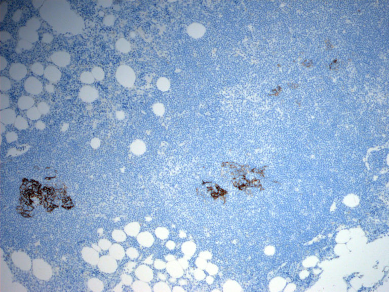 CD23 – Antibody Lexicon